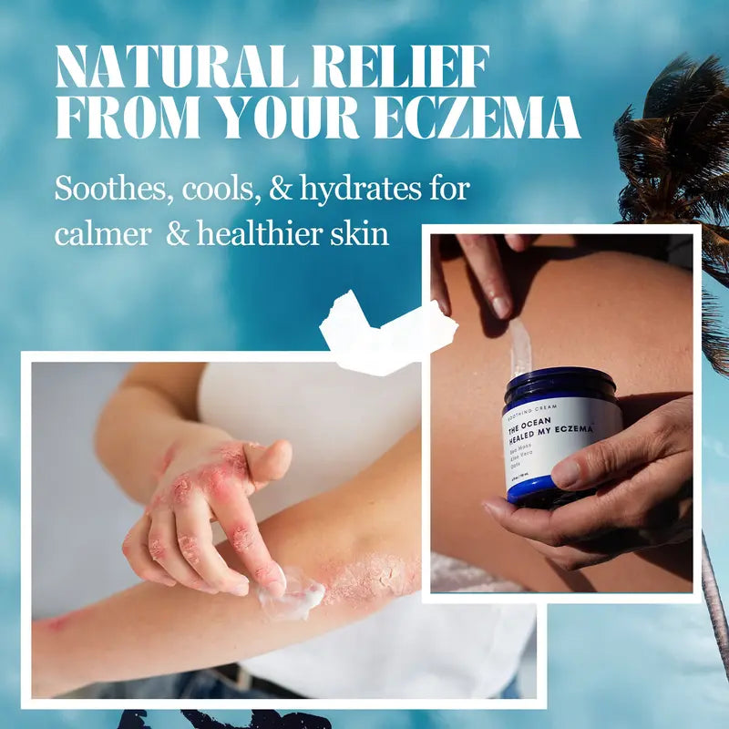 Say Goodbye To Itchy, Irritated Skin—Naturally
