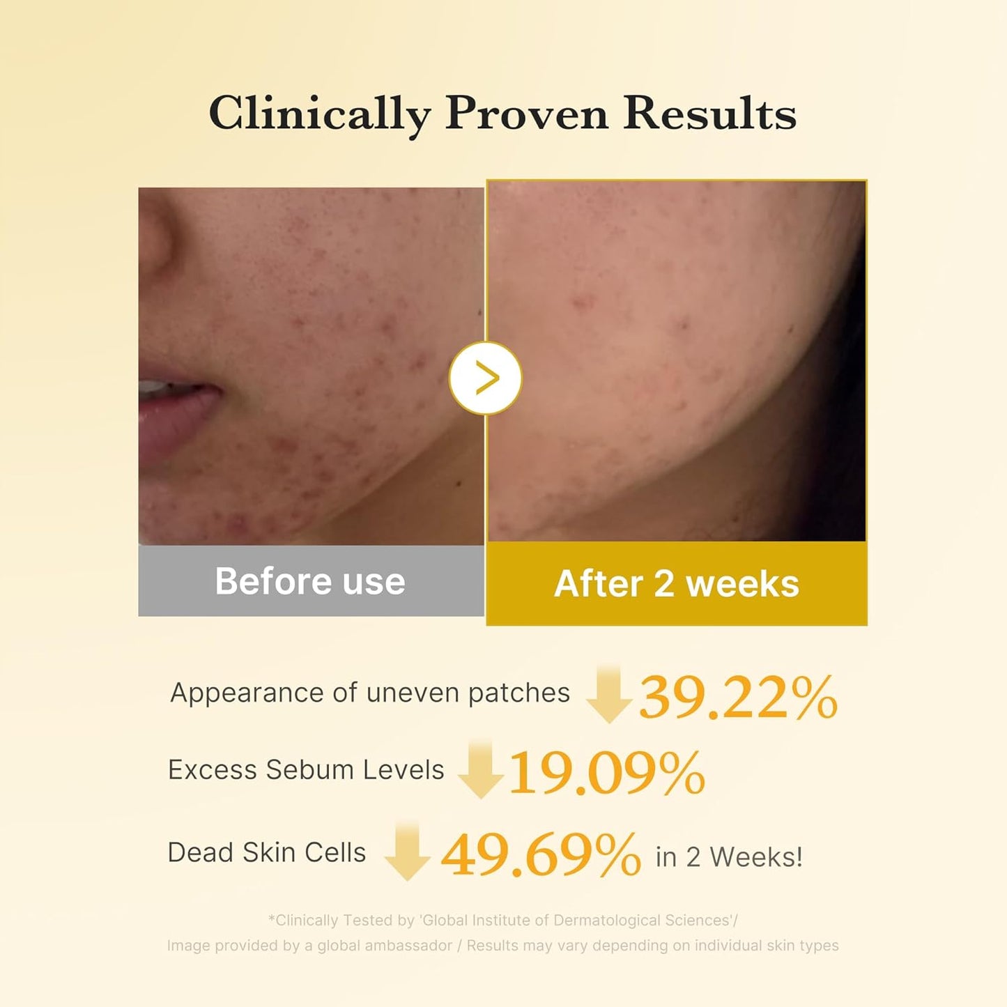 Fades Dark Spots. Flawless Glow. Powered by Kojic Acid & Turmeric.