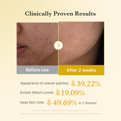 Fades Dark Spots. Flawless Glow. Powered by Kojic Acid & Turmeric.