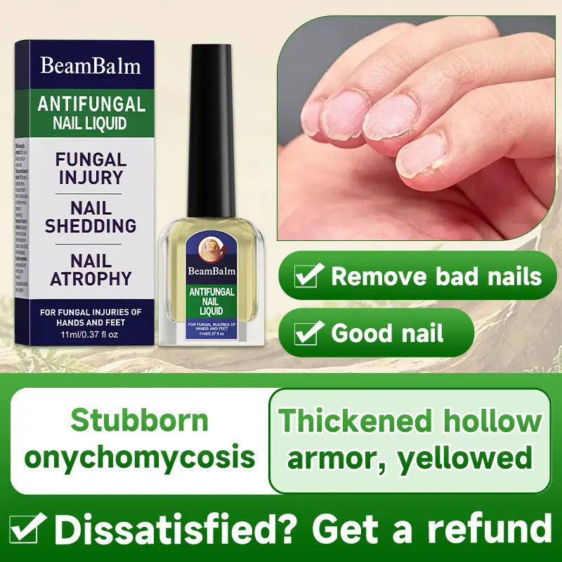 Professional Grade Extra Strength Toenail Fungus Recovery Cream