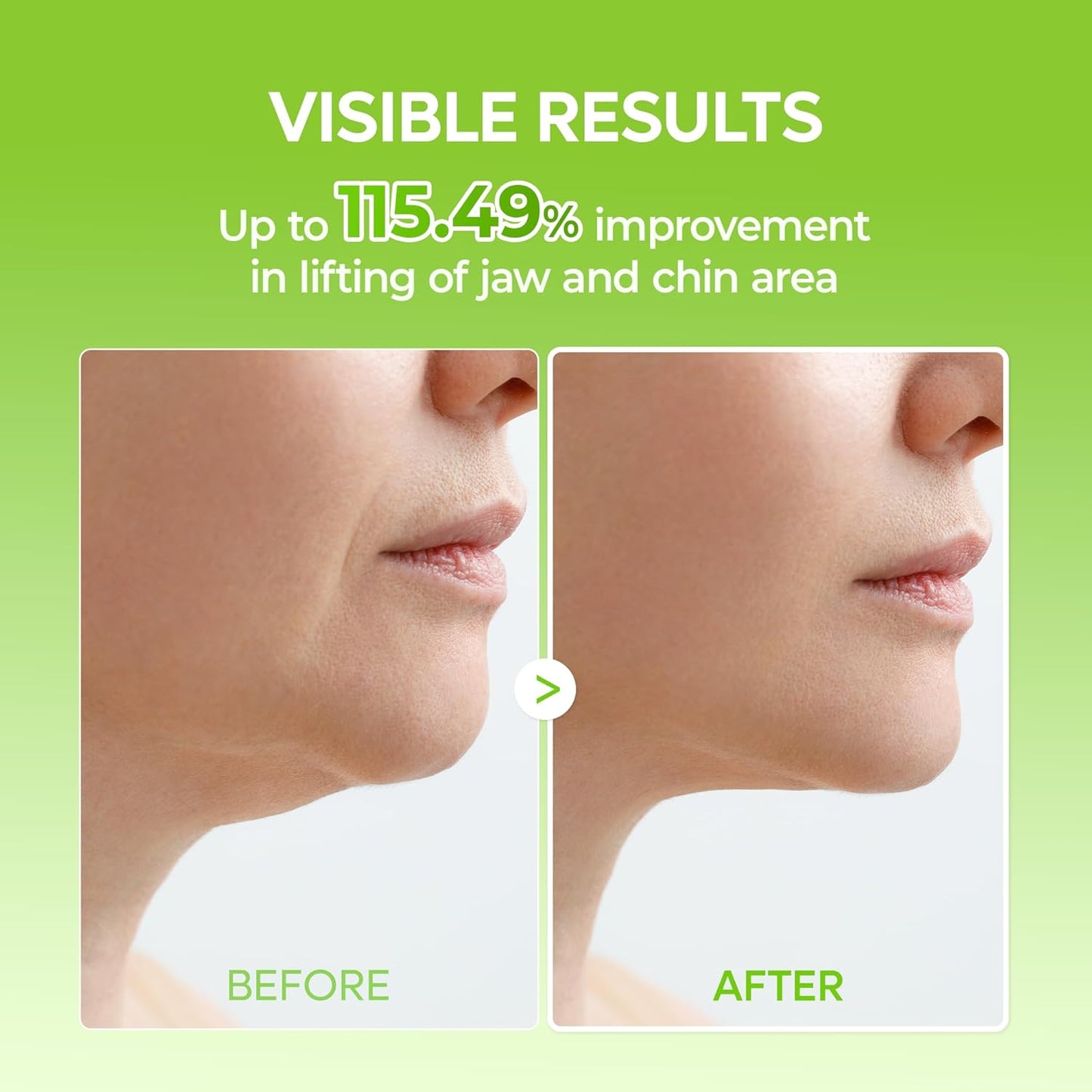 Sculpt Your Jawline. Chill Away the Puff.