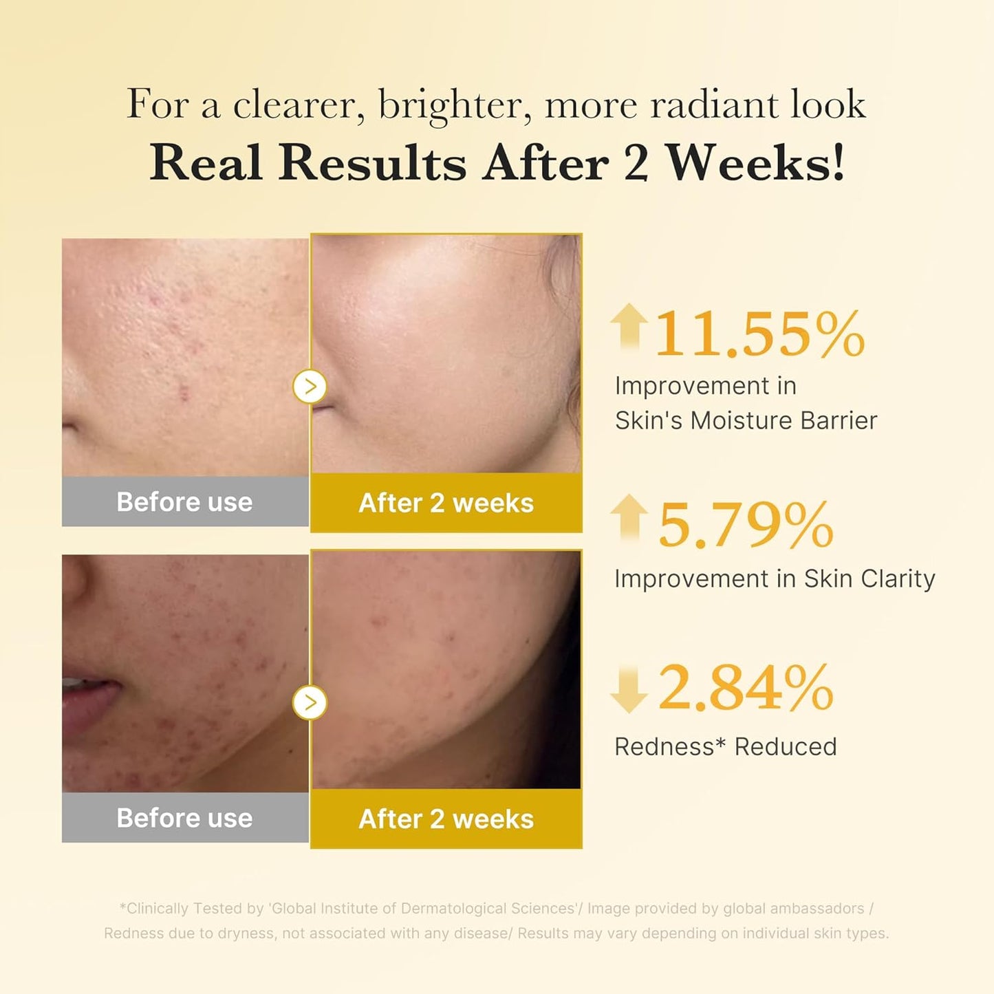 Fades Dark Spots. Flawless Glow. Powered by Kojic Acid & Turmeric.