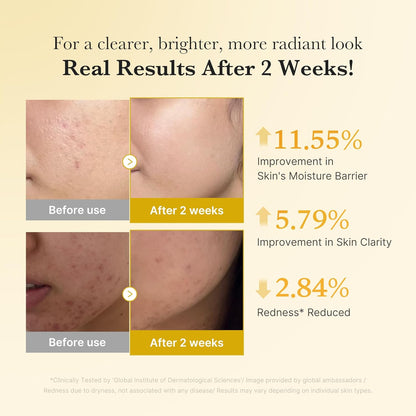 Fades Dark Spots. Flawless Glow. Powered by Kojic Acid & Turmeric.