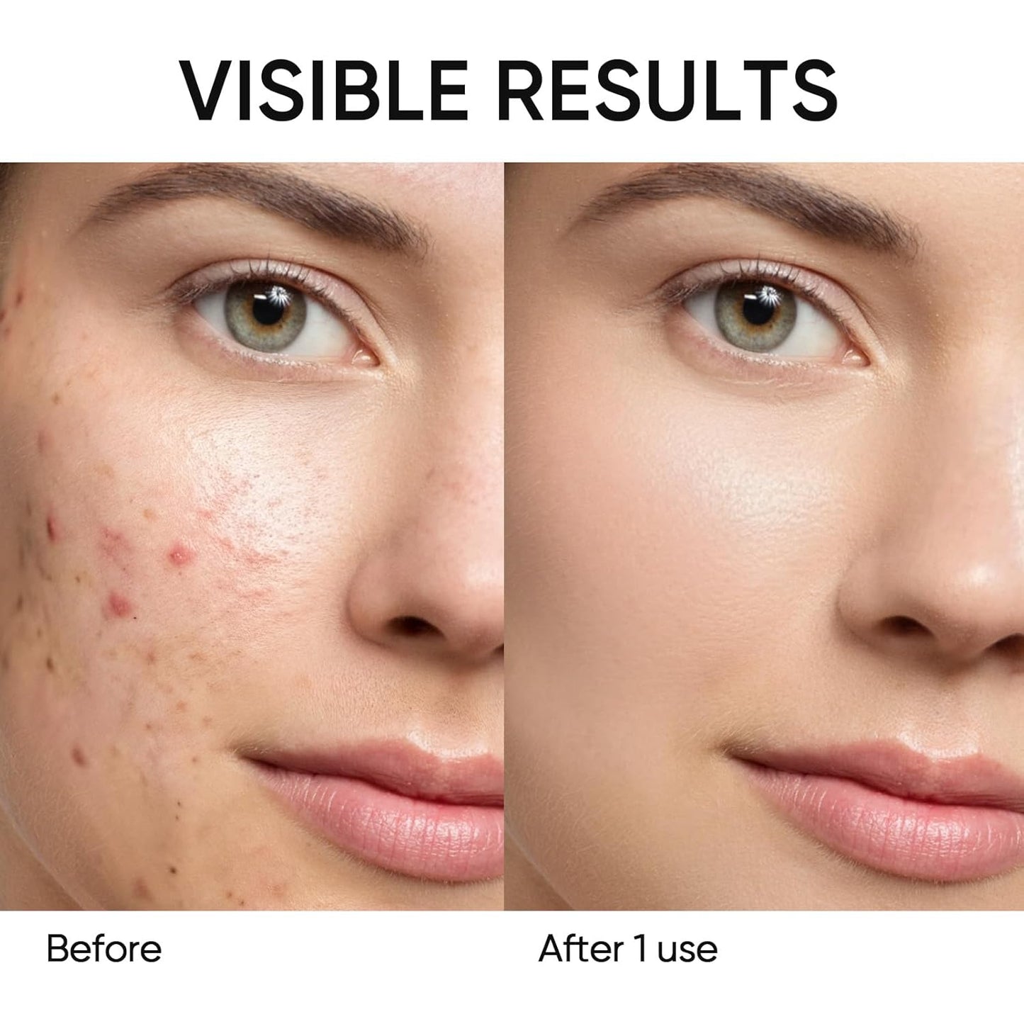 Erase Blackheads. Shrink Pores. Zero Mess. The 60-Second Clay Stick.