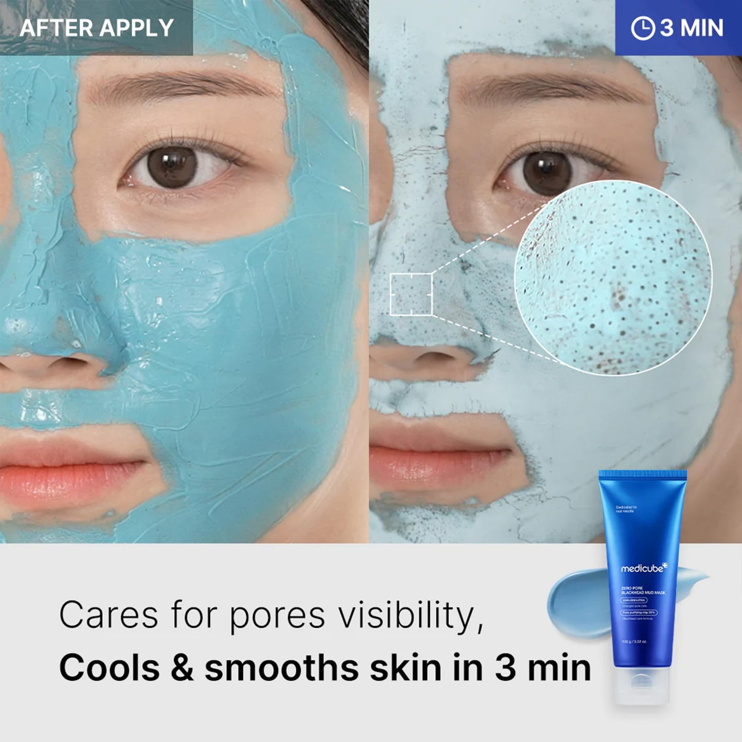 Medicube Zero Pore Mud Mask: Blackhead Clearing & Pore Tightening with AHA/BHA/PHA – 100g / 3.52 oz